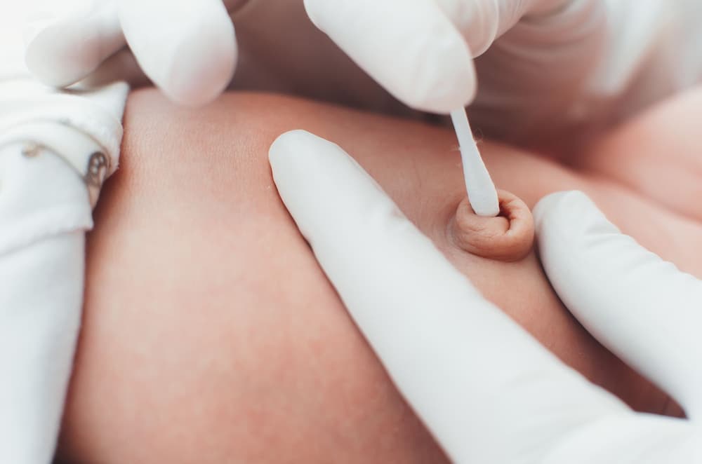 Wydzielina z pępka – co to znaczy, jakie są przyczyny, co robić, jak leczyć?