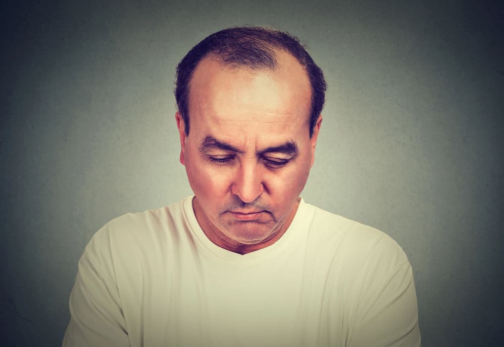 Wypadanie włosów u mężczyzn – przyczyny i leczenie