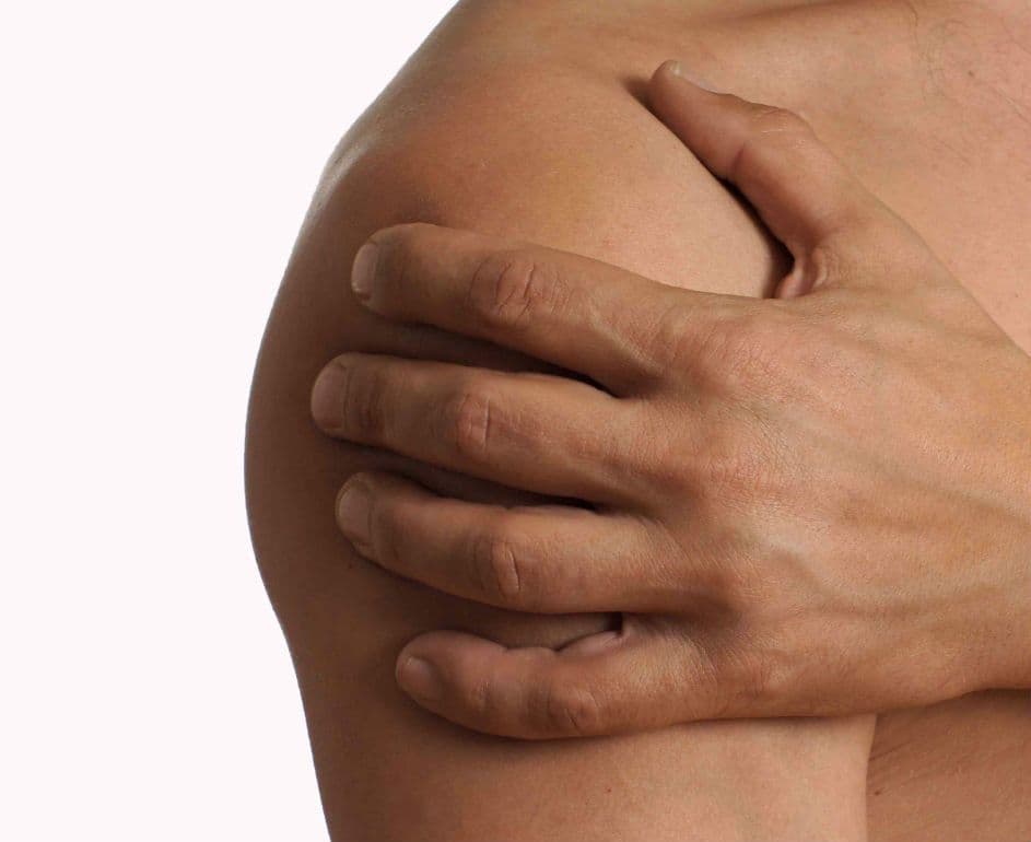 Wybity bark (zwichnięcie stawu ramiennego) – przyczyny, objawy i rehabilitacja