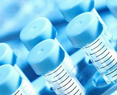 Zespół niewrażliwości na androgeny – czym jest, jak rozpoznać, jak leczyć