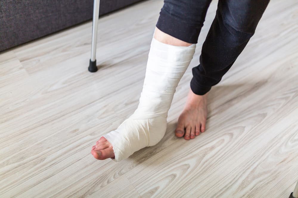 Złamanie kostki bocznej stawu skokowego – jak leczyć i jaka rehabilitacja?