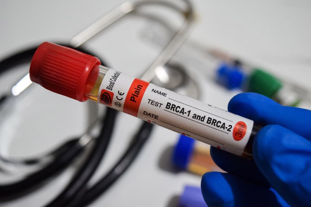 próbka krwi na badanie BRCA-1 i BRCA-2 próbka krwi na badanie BRCA-1 i BRCA-2