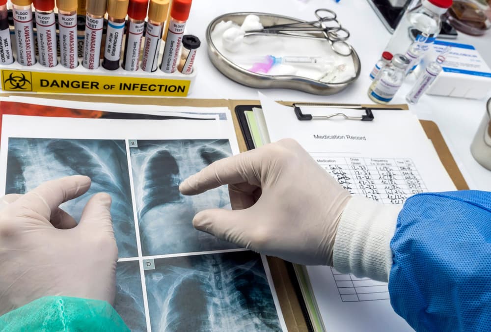 Lekarz zapoznający się z wynikami badań Lekarz zapoznający się z wynikami badań