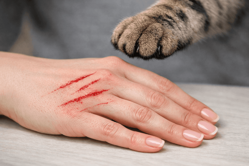 Choroba kociego pazura: łagodna czy groźna? Fakty, objawy i leczenie Choroba kociego pazura: łagodna czy groźna? Fakty, objawy i leczenie