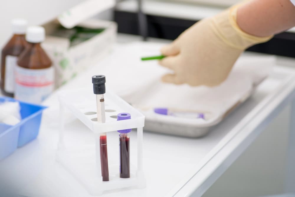 probówki z krwią w laboratorium probówki z krwią w laboratorium