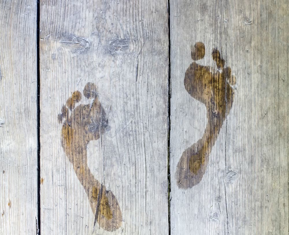 Pocenie stóp – przyczyny i leczenie nadmiernej potliwości nóg Pocenie stóp – przyczyny i leczenie nadmiernej potliwości nóg