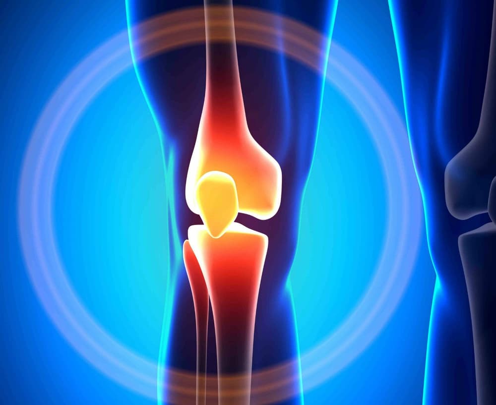 Strzelające stawy – przyczyny, leczenie, rehabilitacja Strzelające stawy – przyczyny, leczenie, rehabilitacja