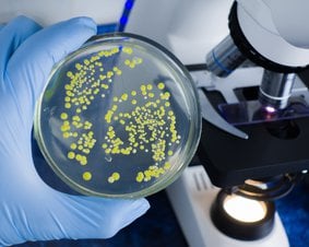 bakterie e-coli