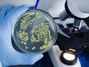 bakterie e-coli