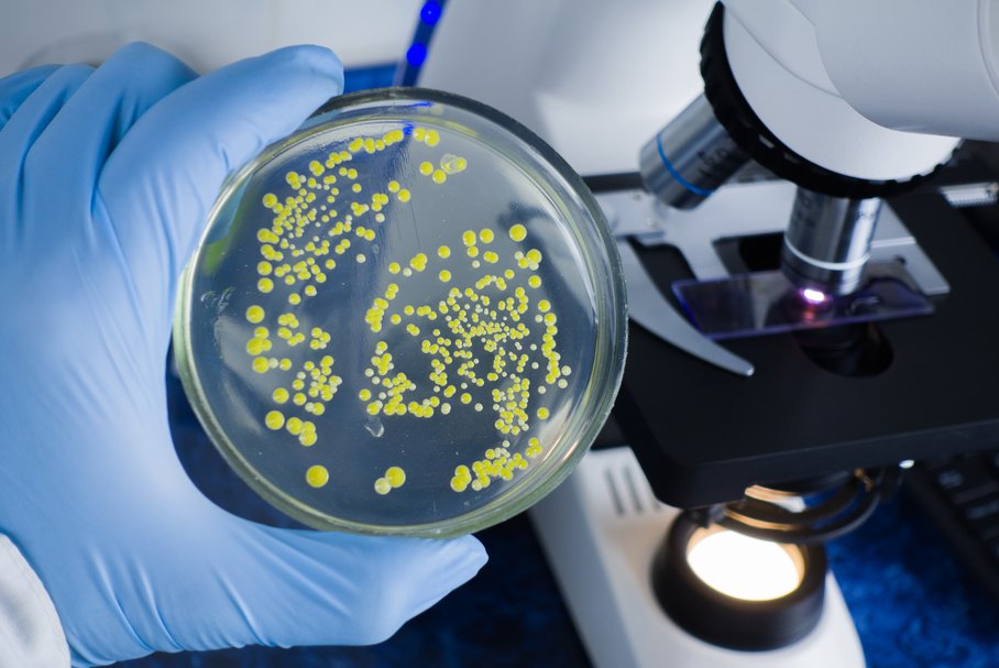 bakterie e-coli