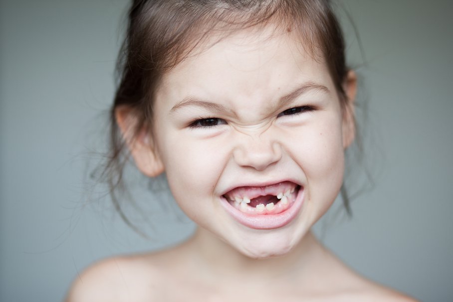 wypadanie zębów mlecznych u dzieci
