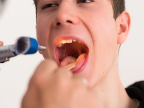 Angina wirusowa czy bakteryjna