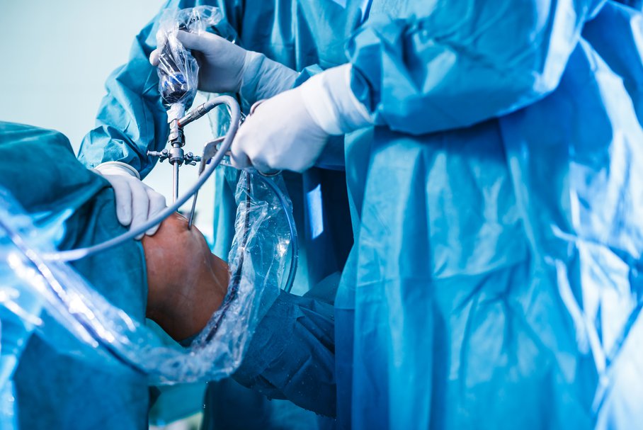Artroskopia kolana – wskazania, przebieg zabiegu, rekonwalescencja, powikłania