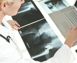 Zapalenie kości i stawów – przyczyny, objawy, leczenie, powikłania