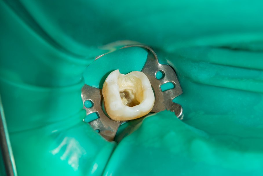 Endodoncja