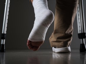 Złamana noga - jak się objawia?
