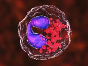 Neutropenia – przyczyny