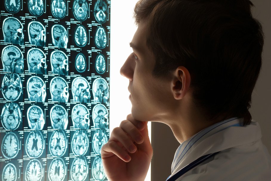 Udar niedokrwienny mózgu – diagnostyka i leczenie