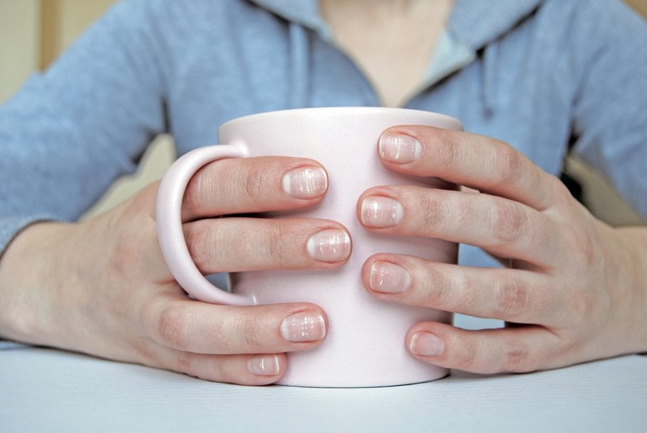 Przebarwienia na paznokciach –  jakie są przyczyny przebarwień paznokci?