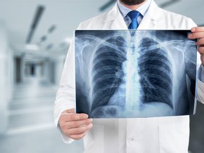 Diagnostyka śródmiąższowego zapalenia płuc