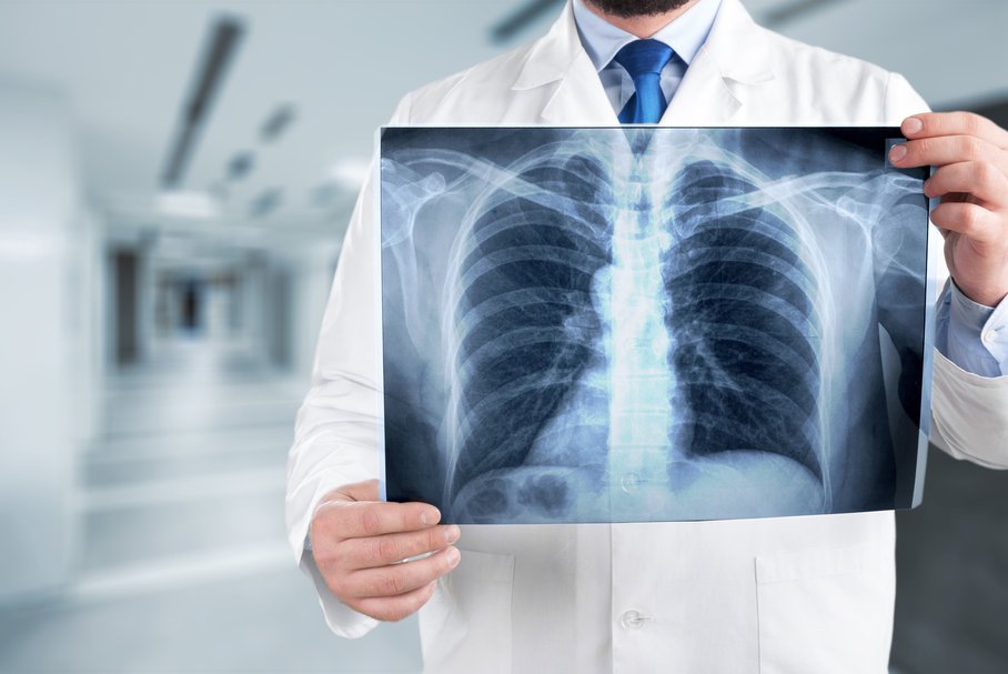 Diagnostyka śródmiąższowego zapalenia płuc