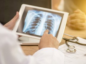 Drenaż opłucnej – wskazania i powikłania odbarczenia opłucnej