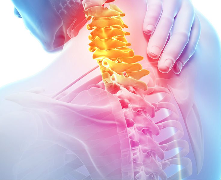 Stenoza kanału kręgowego – przyczyny, objawy, leczenie, operacja, rehabilitacja