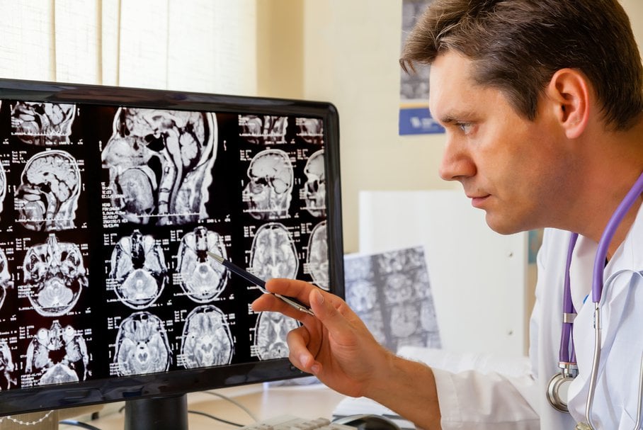 Neurolog oglądający szyszynkę na zdjęciach RTG mózgu.