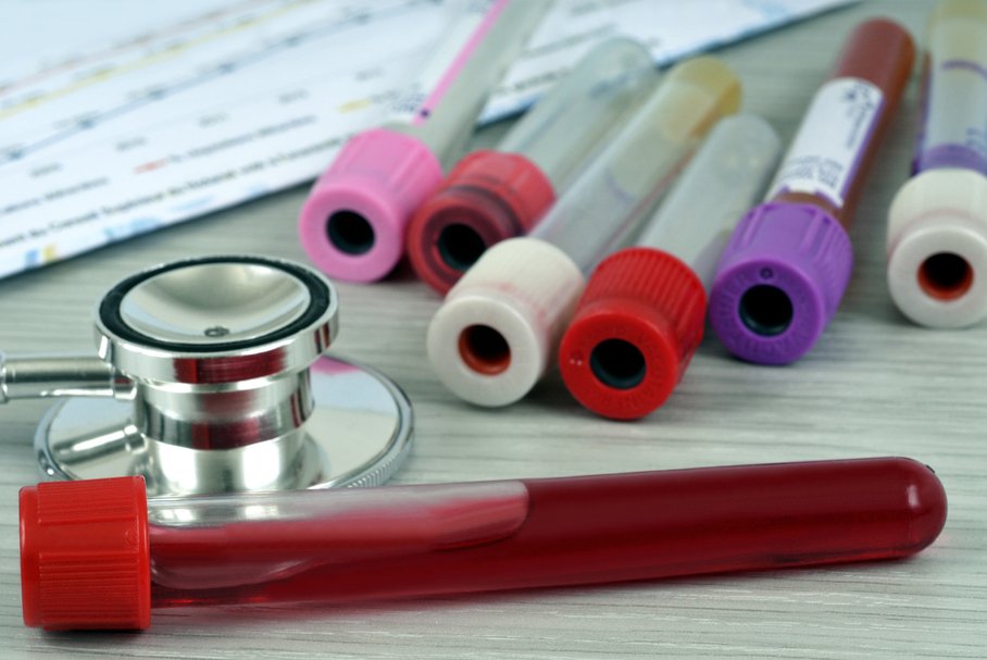 Testy alergiczne z krwi – badanie IgE całkowitych i swoistych