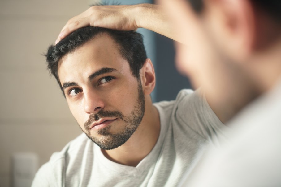 Hormony a włosy – łysienie androgenowe