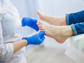 Jakie objawy ma grzybica skóry gładkiej?