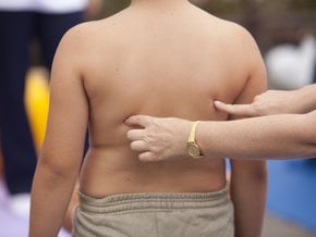 nadwaga i otyłość u dziecka