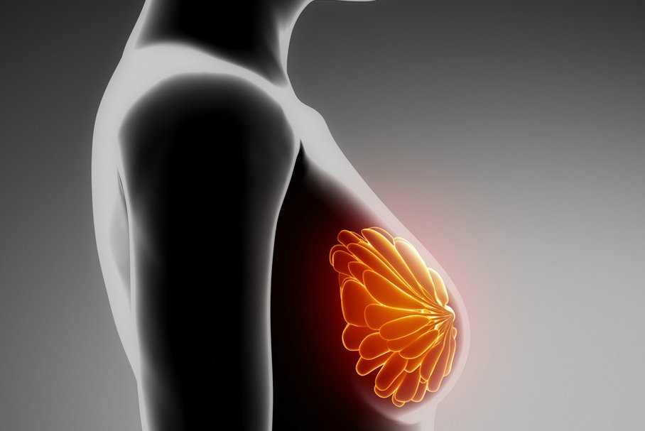 Przyczyny raka piersi - najważniejsze czynniki ryzyka raka piersi