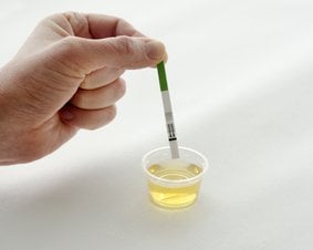 test owulacyjny kiedy zrobić