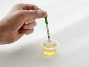 test owulacyjny kiedy zrobić