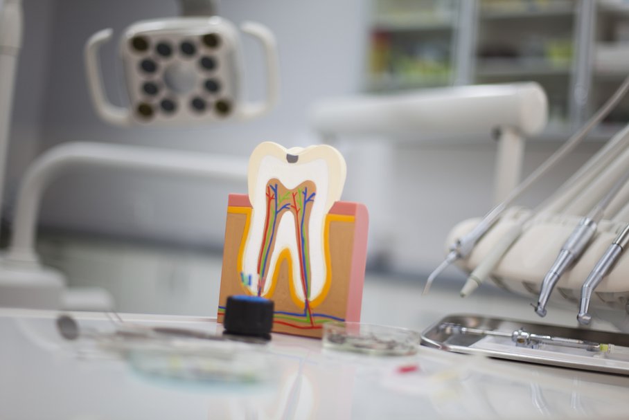 Rodzaje plomb dentystycznych – amalgamatowe, glassjonomerowe, kompozytowe, porcelanowe – wypadanie, cena, refundacja
