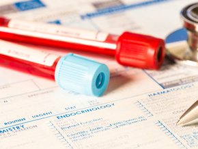 Cholesterol a alkohol