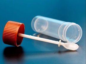 Test na krew utajoną w kale – jakie badanie na krew utajoną wybrać?