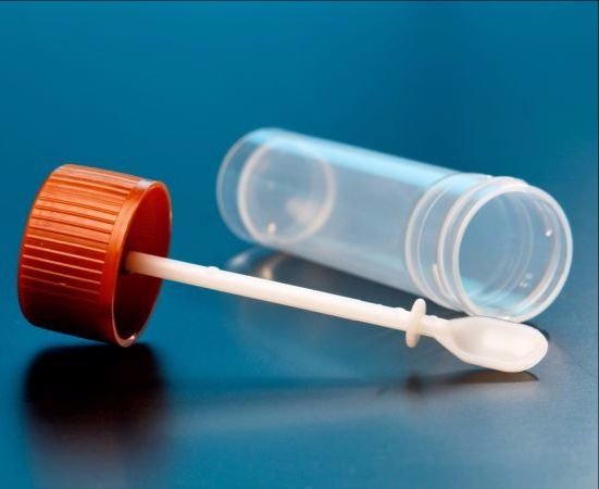 Test na krew utajoną w kale – jakie badanie na krew utajoną wybrać?