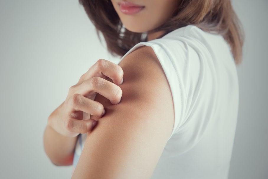 Pieczenie skóry – przyczyny. Jak leczyć pieczenie skóry?