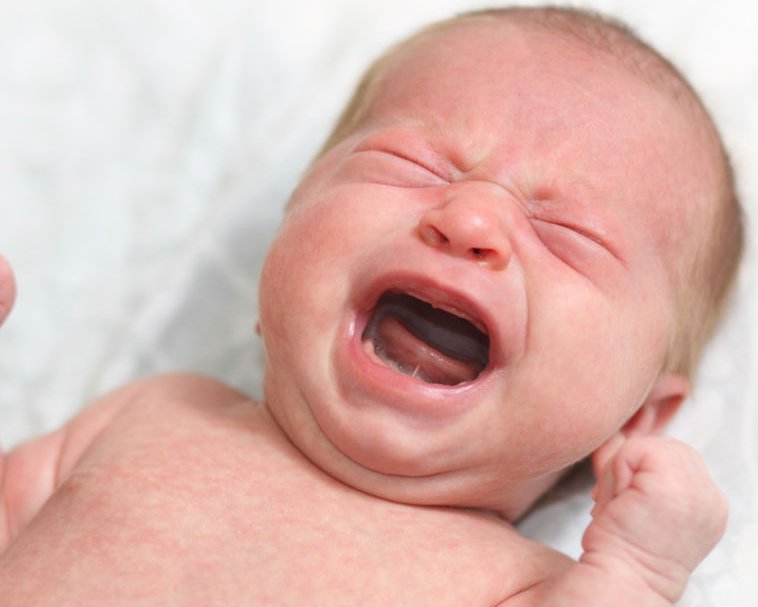 Grypa u niemowląt – jak rozpoznać i leczyć?