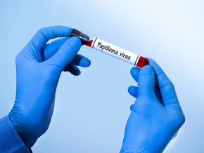 test na wirusa HPV