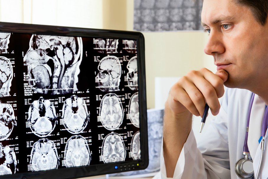 Neurolog oglądający obrazy tomograficzne mózgu na komputerze.