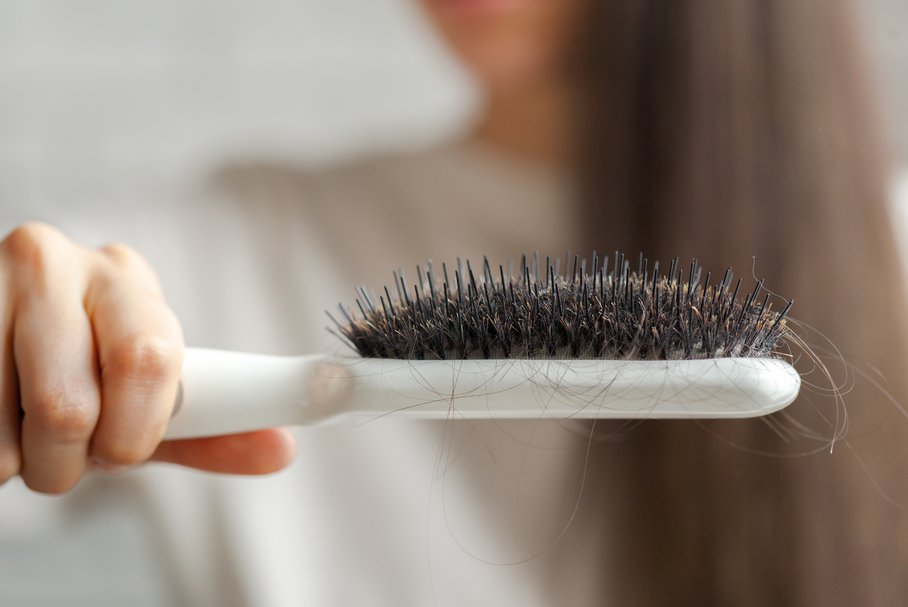 Przyczyny łysienia u kobiet