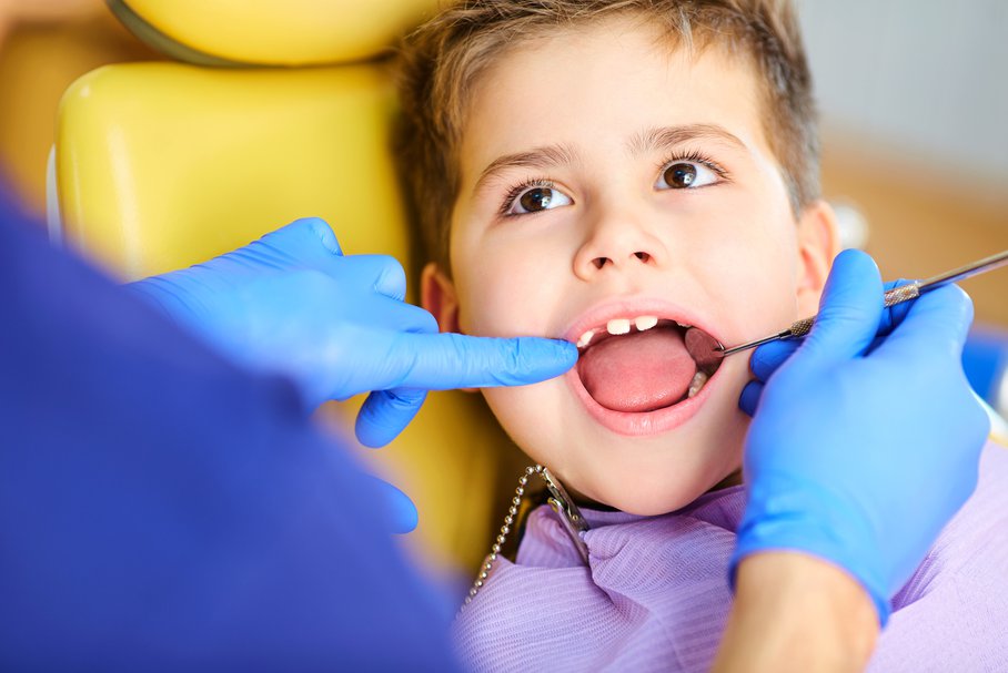 Białe plamy na zębach – jakie są przyczyny, jak się ich pozbyć i w jaki sposób je usunąć?