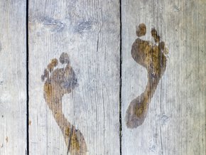 Pocenie stóp – przyczyny i leczenie nadmiernej potliwości nóg