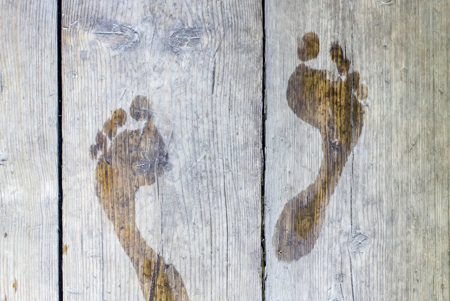 Pocenie stóp – przyczyny i leczenie nadmiernej potliwości nóg