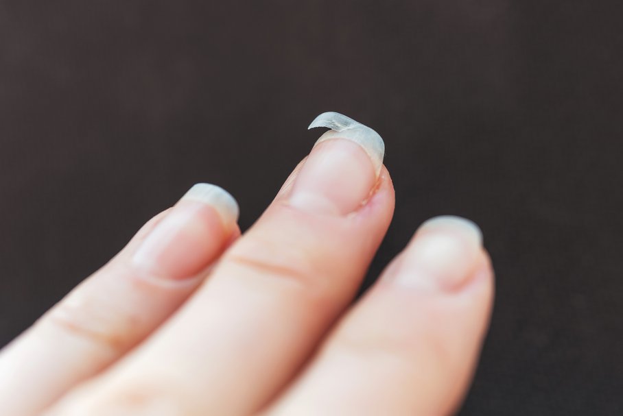 Złamany paznokieć – jak postępować?