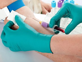 Pobieranie krwi badanie stężenia testosteronu