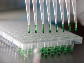 Zespół Aperta – patologicznie zrośnięcie się szwów czaszkowych